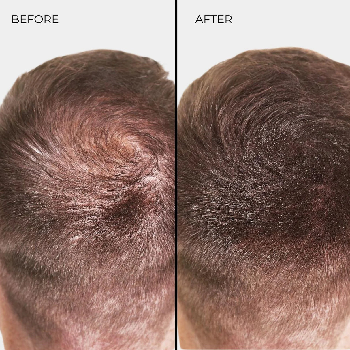 Nanogen Plaukų Pudra Šviesiai Ruda 15g