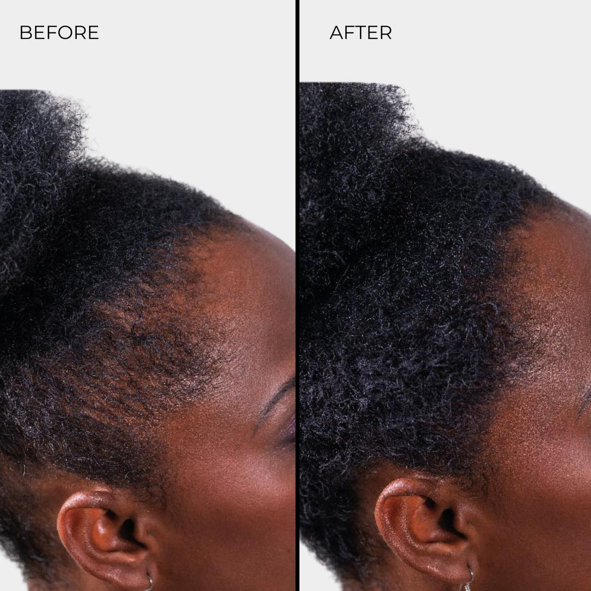 Nanogen Hair Thickening Fibre Black - BVShop