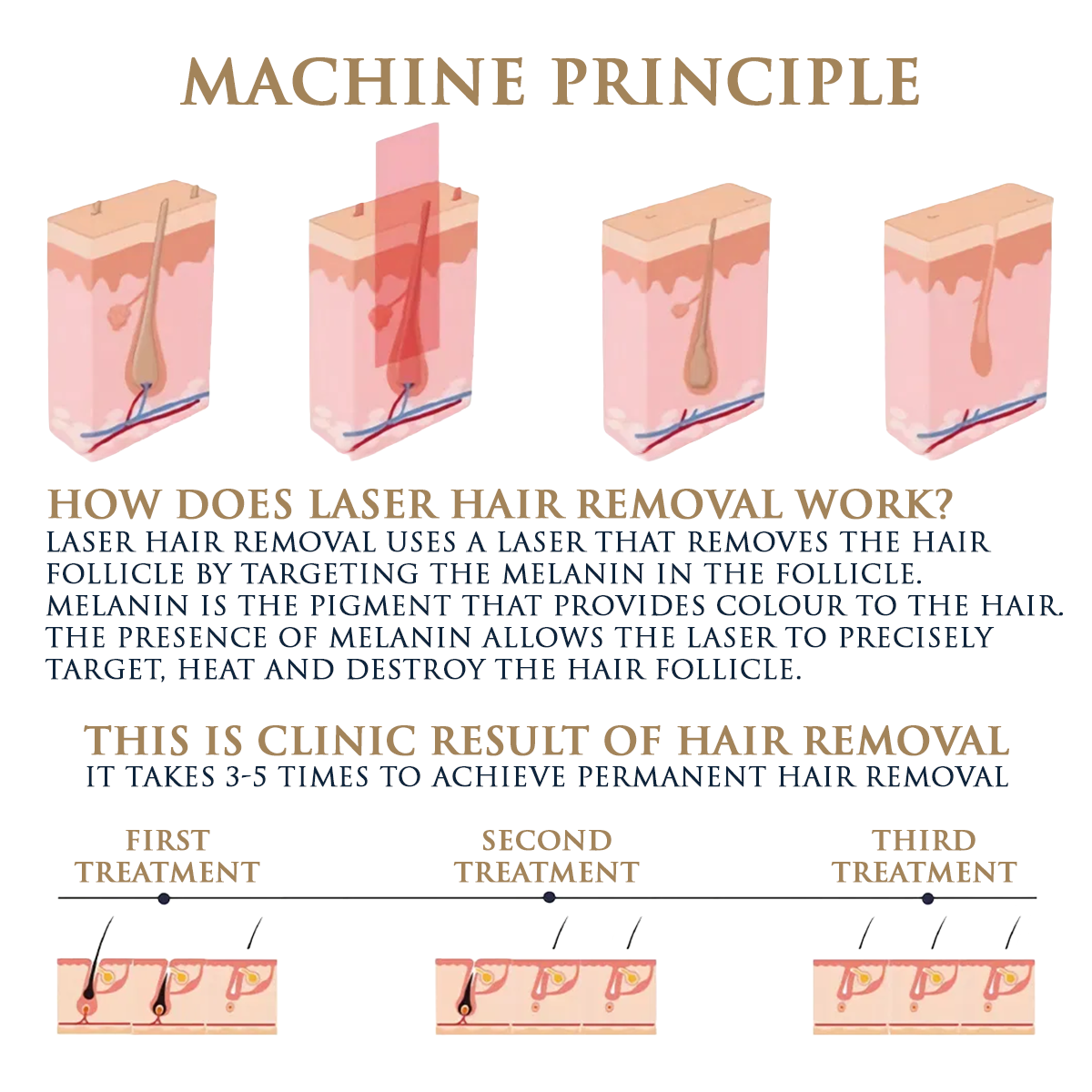Skin Monarch Quantum Pro Diodinis ir Pikosekundinis Lazeris
