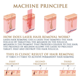 Skin Monarch Quantum Pro Diodinis ir Pikosekundinis Lazeris